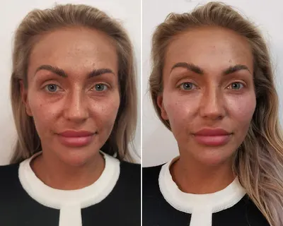 Medycyna Estetyczna Sylwia Ziółkowska